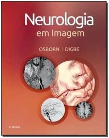 Neurologia em Imagem